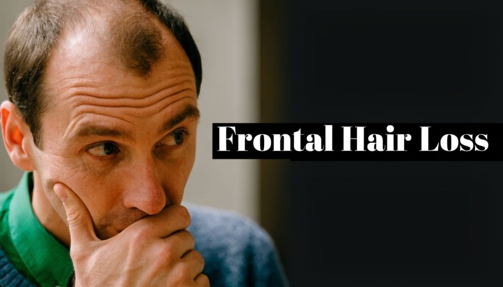 Hair Loss in Front of Head: A Man’s Guide to Causes &&nbsp;PRP
